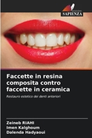 Faccette in resina composita contro faccette in ceramica (Italian Edition) 6208587964 Book Cover