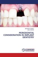Periodontal Consideration in Implant Dentistry 620615579X Book Cover