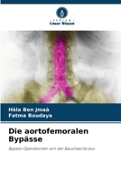Die aortofemoralen Bypässe (German Edition) 6208042208 Book Cover