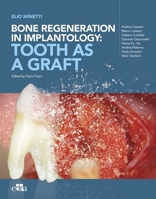 Bone regeneration in implantology:tooth as a graft 8821455343 Book Cover