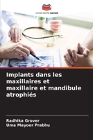 Implants dans les maxillaires et maxillaire et mandibule atrophiés (French Edition) 6208351308 Book Cover
