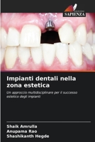 Impianti dentali nella zona estetica 6209088252 Book Cover