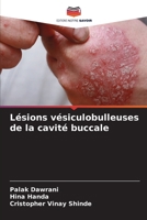 Lésions vésiculobulleuses de la cavité buccale (French Edition) 6208119324 Book Cover
