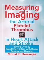 Measuring and Imaging the Arterial Platelet Thrombus in Heart Attack and Stroke: : Saving Lives by Rapid Intervention with Drugs, Devices and Genetics 1663212031 Book Cover