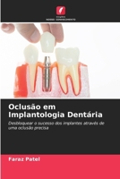 Oclusão em Implantologia Dentária (Portuguese Edition) 620658254X Book Cover