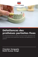 Défaillances des prothèses partielles fixes (French Edition) 6207552059 Book Cover