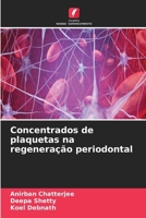 Concentrados de plaquetas na regeneração periodontal (Portuguese Edition) 663013978X Book Cover