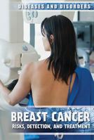 Breast Cancer: Risks, Detection, and Treatment 1534562834 Book Cover