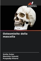 Osteomieite della mascella 620607627X Book Cover