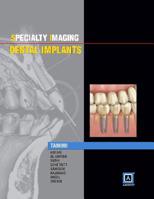 Specialty Imaging: Dental Implants 1937242196 Book Cover
