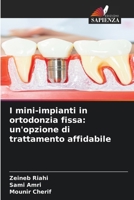 I mini-impianti in ortodonzia fissa: un'opzione di trattamento affidabile (Italian Edition) 620815927X Book Cover