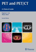PET and PET/CT: A Clinical Guide 1604061537 Book Cover