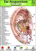 Ear Acupuncture: French Points & Images 3869570075 Book Cover