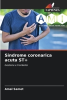 Sindrome coronarica acuta ST+: Gestione e trombolisi (Italian Edition) 6208656818 Book Cover