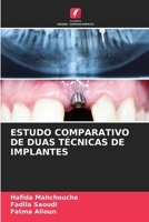 Estudo Comparativo de Duas Técnicas de Implantes (Portuguese Edition) 6206659658 Book Cover