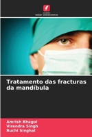 Tratamento das fracturas da mandíbula (Portuguese Edition) 6207695429 Book Cover