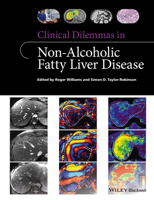 Clinical Dilemmas in Non-Alcoholic Fatty Liver Disease 1118912039 Book Cover