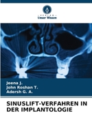 Sinuslift-Verfahren in Der Implantologie (German Edition) 6208015359 Book Cover