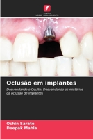 Oclusão em implantes: Desvendando o Oculto: Desvendando os mistérios da oclusão de implantes 6206119874 Book Cover