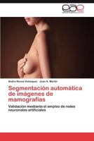 Segmentacion Automatica de Imagenes de Mamografias 3847367951 Book Cover
