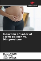 Induction of Labor at Term: Balloon vs. Dinoprostone 6630387279 Book Cover