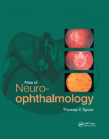 Atlas of Neuro-Ophthalmology 0367394340 Book Cover