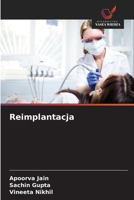Reimplantacja (Polish Edition) 620074923X Book Cover