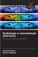 Radiologia w stomatologii dzieciecej (Polish Edition) 6209812252 Book Cover