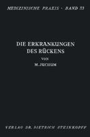 Die Erkrankungen Des Ruckens: Pathologie Und Therapie 3642862543 Book Cover