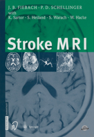 Stroke MRI 3642573886 Book Cover