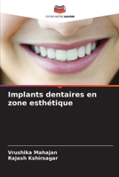 Implants dentaires en zone esthétique 6207259718 Book Cover