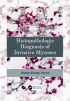 Histopathologic Diagnosis of Invasive Mycoses 103230670X Book Cover