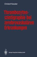 Thrombozytenszintigraphie Bei Zerebrovaskularen Erkrankungen: Methodik . Ergebnisse . Indikationen 354052598X Book Cover