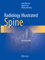 Radiology Illustrated: Spine 9819966116 Book Cover