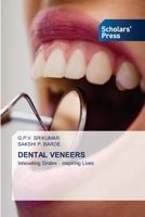 Dental Veneers 620677399X Book Cover