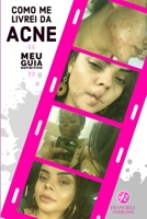 COMO ME LIVREI DA ACNE - Meu guia definitivo: Como consegui controlar o problema que me causou tanto sofrimento (Portuguese Edition) B08HTG656X Book Cover