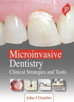 Microinvasive Dentistry: Clinical Strategies and Tools 1909836729 Book Cover