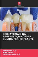 Biomateriais Na Regeneração Óssea Guiada Peri-Implante (Portuguese Edition) 6630578341 Book Cover