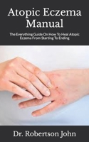 Atopic Eczema Manual: The Everything Guide On How To Heal Atopic Eczema From Starting To Ending null Book Cover