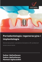 Periodontologia regeneracyjna i implantologia 620905787X Book Cover