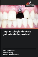 Implantologia dentale guidata dalle protesi (Italian Edition) 6207077881 Book Cover