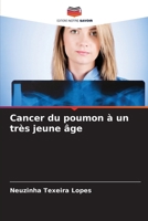 Cancer du poumon à un très jeune âge (French Edition) 6207988892 Book Cover