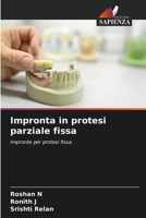 Impronta in protesi parziale fissa (Italian Edition) 6630516915 Book Cover