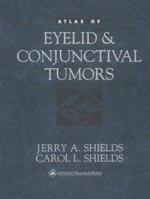 Atlas of Eyelid and Conjunctival Tumors 0781719151 Book Cover