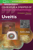 Uveitis 1496363000 Book Cover