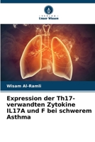 Expression der Th17-verwandten Zytokine IL17A und F bei schwerem Asthma (German Edition) B0CL7ZVMQC Book Cover