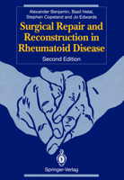 Surgical Repair and Reconstruction in Rheumatoid Disease 1447119444 Book Cover