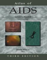 Atlas of AIDS (Atlas of Infectious Diseases 1573401560 Book Cover