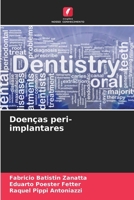 Doenças peri-implantares (Portuguese Edition) 6208693888 Book Cover
