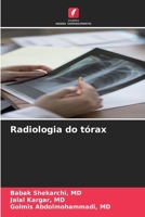 Radiologia do tórax (Portuguese Edition) 6208642124 Book Cover